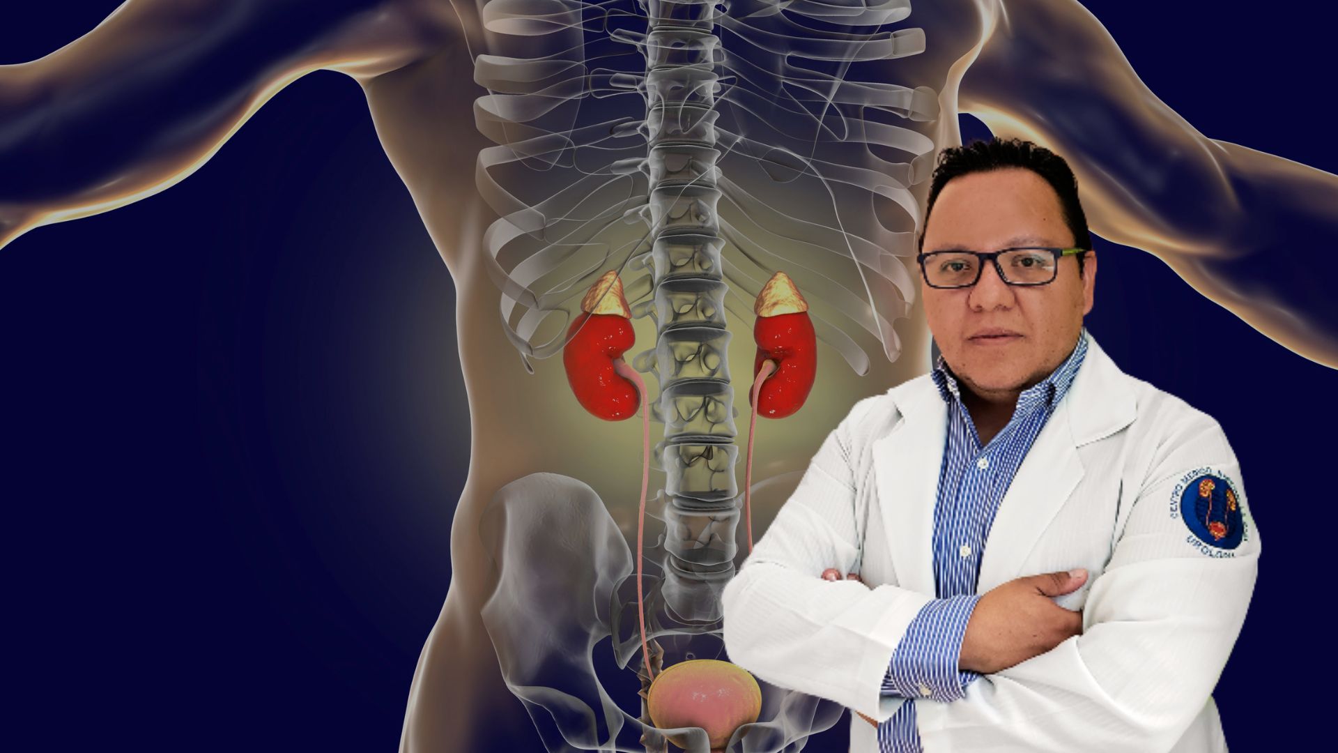 Litotricia láser en Pachuca